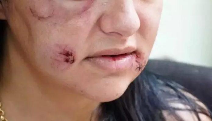 Pouco conhecido, auxílio aluguel é “socorro” para vítimas de violência doméstica