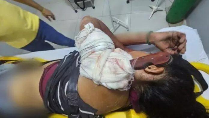 Mulher fica com faca cravada no ombro ao ser agredida pelo ex-companheiro